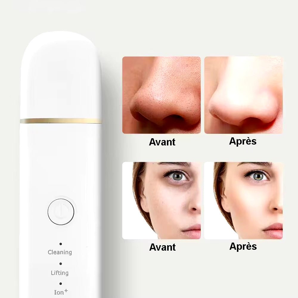 Extracteur de points noirs ultrasonic - Launchify